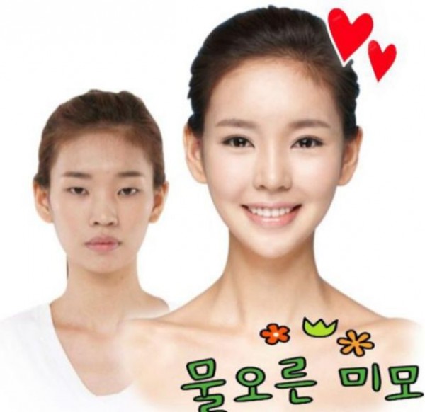 before_and_after_photos_of_korean_plastic_surgery_640_16