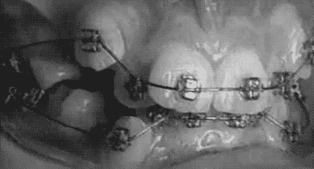 ortodoncia10