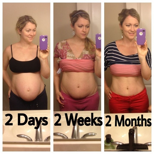body after baby8