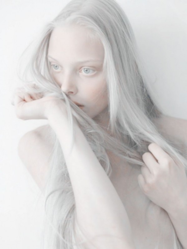 albina