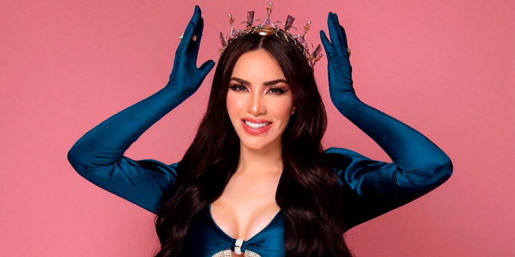 El largo del cabello de Kimberly Loaiza ya es una exageración