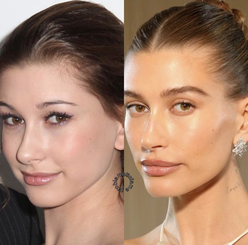 Así lucía Hailey Bieber antes de las cirugías que dice no se hizo | Es ...
